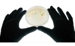 Mycobacterium vaccae - Beneficial Bacteria