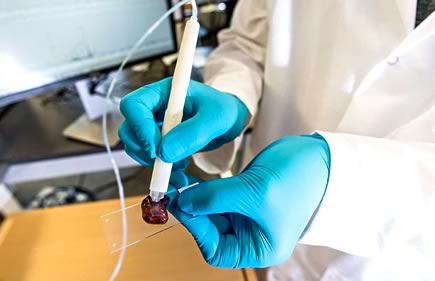 The MasSpec Pen Detecting Cancerous tissue