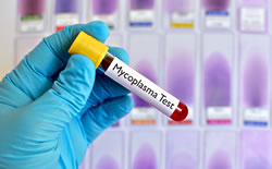 Mycoplasma testing